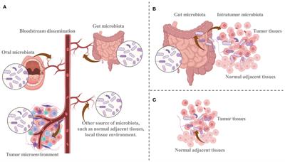 Intratumoral microbiota: implications for cancer onset, progression, and therapy